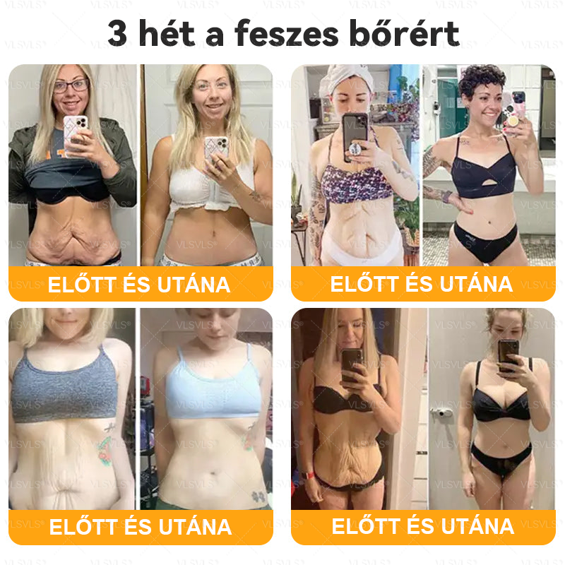 💥Magyarországon készült és innen szállítjuk ✨ VLSVLS® Méhméreg Bőrhelyreállító Krém 🔥 UTOLSÓ NAP – 80% KEDVEZMÉNY