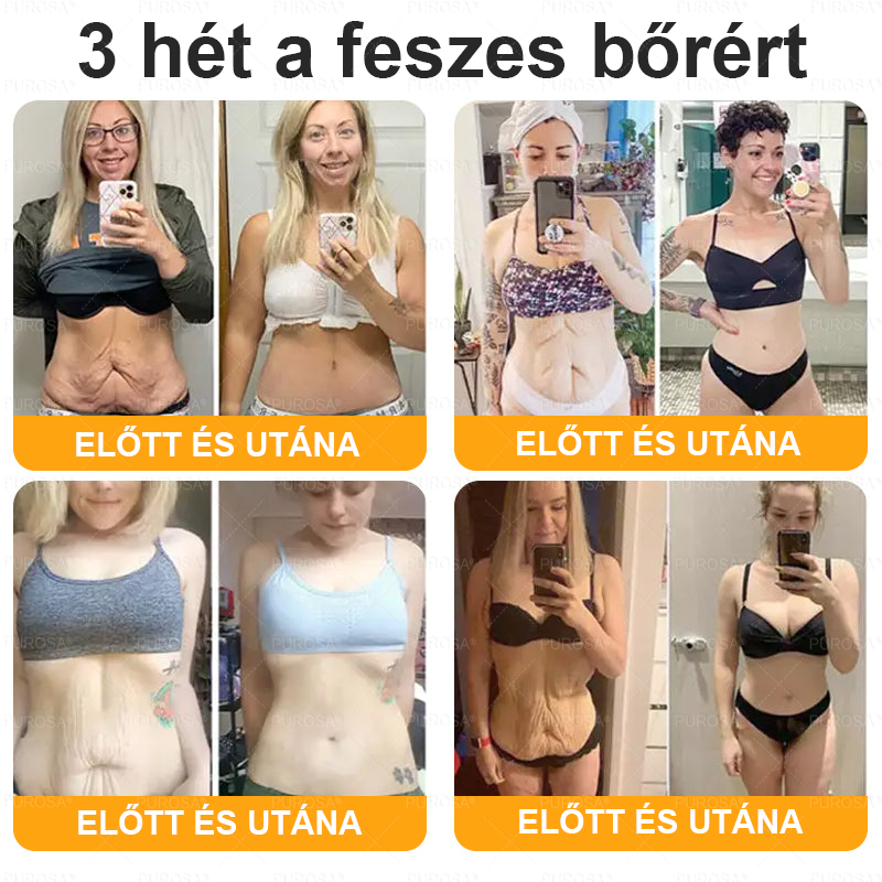 PUROSA® 🎁 Már csak 5 doboz maradt! További 50% kedvezményt biztosítunk! Legyen fitt és egészséges. Ha most veszít, csak jövőre lesz esélye.👍