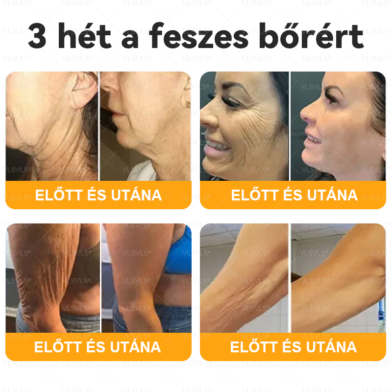 💥Magyarországon készült és innen szállítjuk ✨ VLSVLS® Méhméreg Bőrhelyreállító Krém 🔥 UTOLSÓ NAP – 80% KEDVEZMÉNY