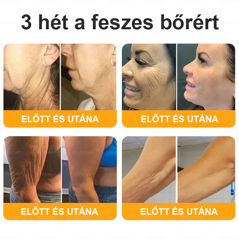PUROSA® 🎁 Már csak 5 doboz maradt! További 50% kedvezményt biztosítunk! Legyen fitt és egészséges. Ha most veszít, csak jövőre lesz esélye.👍