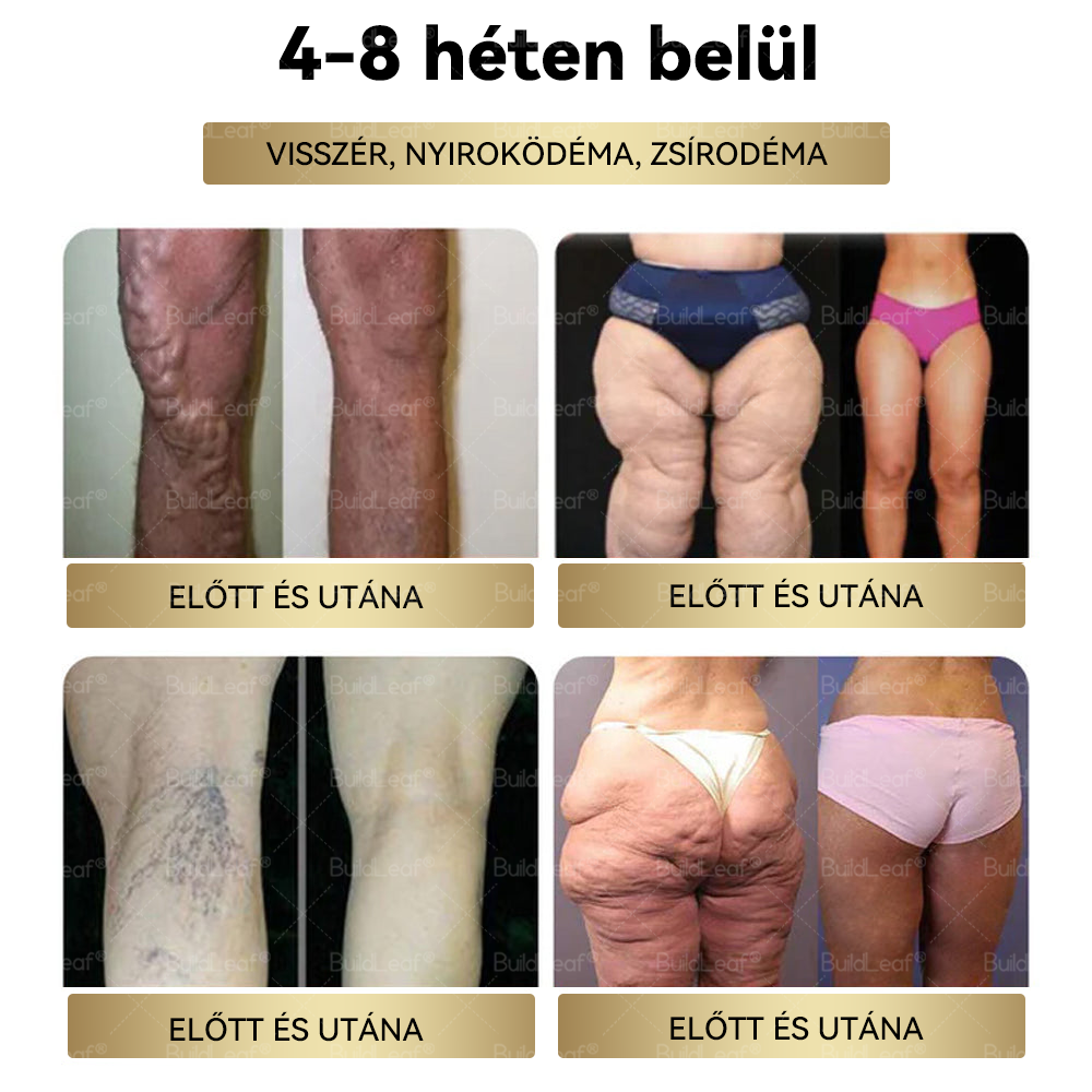 BuildLeaf®🎁 Már csak 5 doboz maradt! További 50% kedvezményt biztosítunk! Legyen fitt és egészséges. Ha most veszít, csak jövőre lesz esélye.🌼
