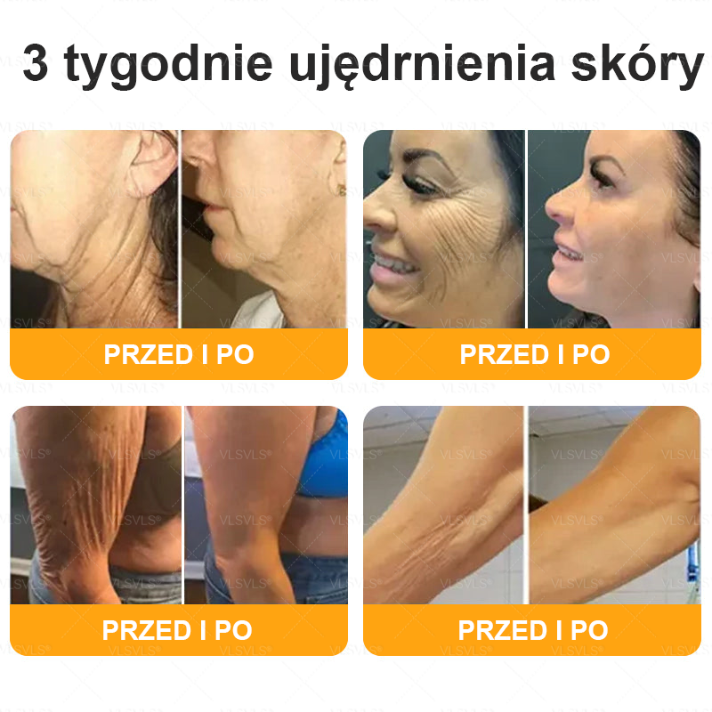 🌟 Wyprodukowano i wysyłane z Polski 🇵🇱 VLSVLS® Regenerujący Krem z Jadem Pszczelim🔥 OSTATNI DZIEŃ: 80% ZNIŻKI