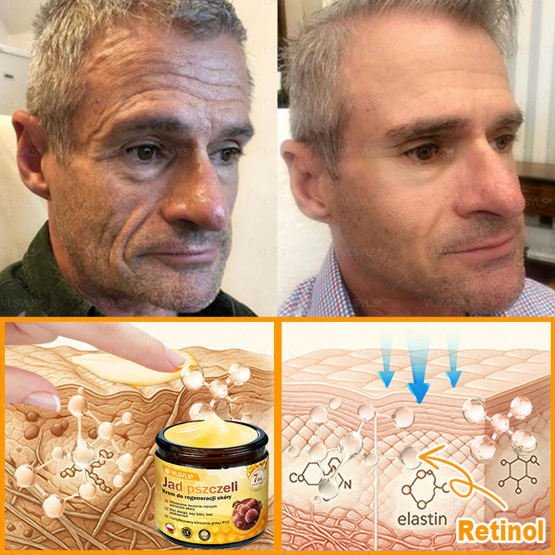 🌟 Wyprodukowano i wysyłane z Polski 🇵🇱 VLSVLS® Regenerujący Krem z Jadem Pszczelim🔥 OSTATNI DZIEŃ: 80% ZNIŻKI