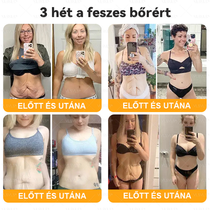 💥Magyarországon készült és innen szállítjuk ✨ VLSVLS® Méhméreg Bőrhelyreállító Krém 🔥 UTOLSÓ NAP – 80% KEDVEZMÉNY