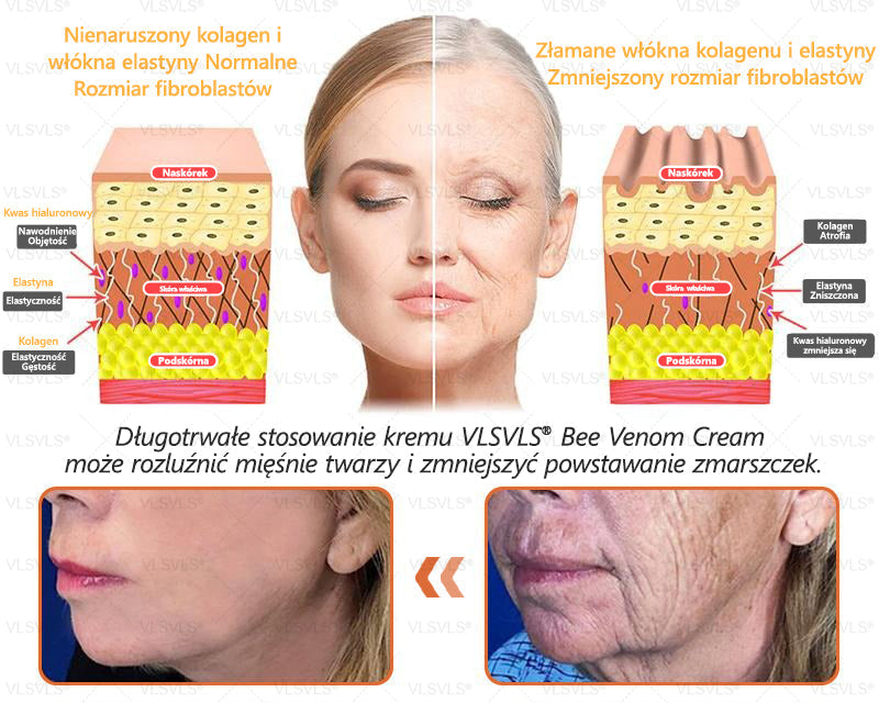 🌟 Wyprodukowano i wysyłane z Polski 🇵🇱 VLSVLS® Regenerujący Krem z Jadem Pszczelim🔥 OSTATNI DZIEŃ: 80% ZNIŻKI