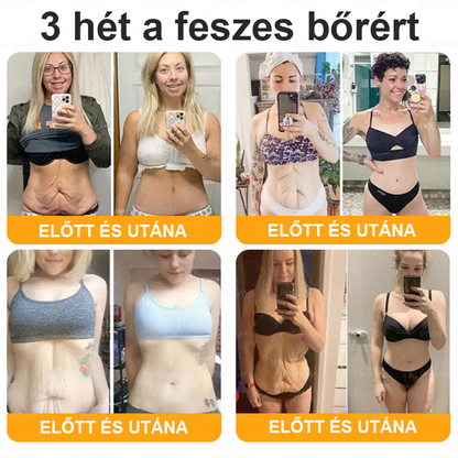 👍PUROSA® Magyarországon készült és innen szállítjuk ✨ PUROSA® Méhméreg Bőrregeneráló Krém 🔥 UTOLSÓ NAP – 80% KEDVEZMÉNY