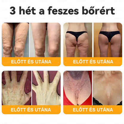 💥Magyarországon készült és innen szállítjuk ✨ VLSVLS® Méhméreg Bőrhelyreállító Krém 🔥 UTOLSÓ NAP – 80% KEDVEZMÉNY