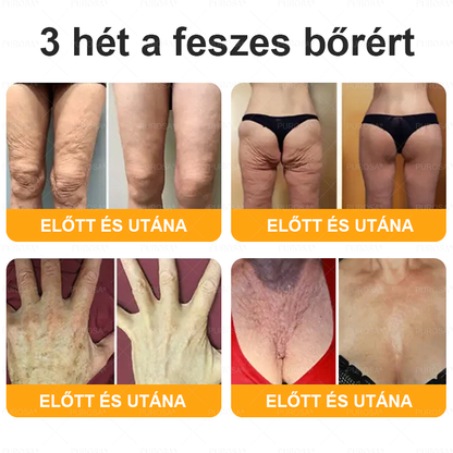 👍PUROSA® Magyarországon készült és innen szállítjuk ✨ PUROSA® Méhméreg Bőrregeneráló Krém 🔥 UTOLSÓ NAP – 80% KEDVEZMÉNY