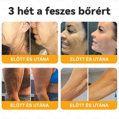 💥Magyarországon készült és innen szállítjuk ✨ VLSVLS® Méhméreg Bőrhelyreállító Krém 🔥 UTOLSÓ NAP – 80% KEDVEZMÉNY