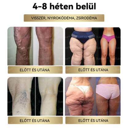 BuildLeaf®🎁 Már csak 5 doboz maradt! További 50% kedvezményt biztosítunk! Legyen fitt és egészséges. Ha most veszít, csak jövőre lesz esélye.🌼