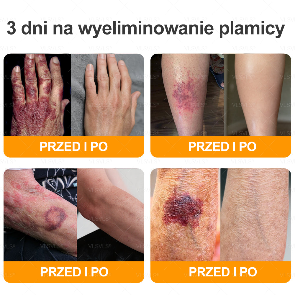 🌟 Wyprodukowano i wysyłane z Polski 🇵🇱 VLSVLS® Regenerujący Krem z Jadem Pszczelim🔥 OSTATNI DZIEŃ: 80% ZNIŻKI