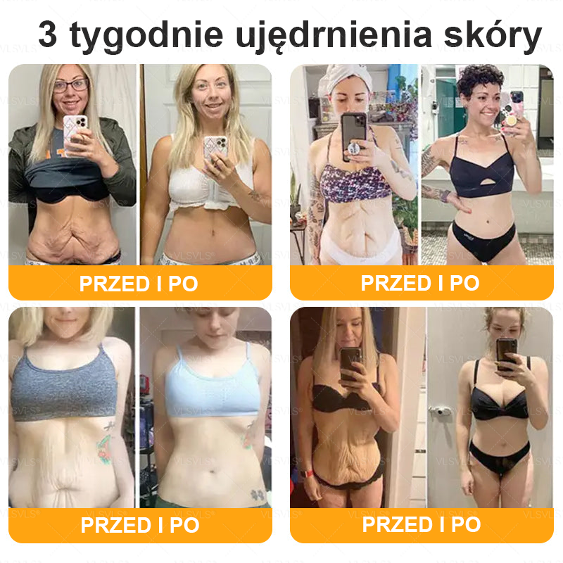 🌟 Wyprodukowano i wysyłane z Polski 🇵🇱 VLSVLS® Regenerujący Krem z Jadem Pszczelim🔥 OSTATNI DZIEŃ: 80% ZNIŻKI
