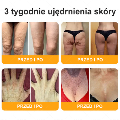 🌟 Wyprodukowano i wysyłane z Polski 🇵🇱 VLSVLS® Regenerujący Krem z Jadem Pszczelim🔥 OSTATNI DZIEŃ: 80% ZNIŻKI